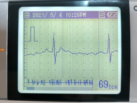 少しましな心電図
