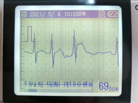 少しましな心電図
