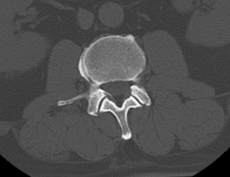 輪切りにしたMRI