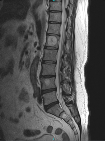 横から見たMRI